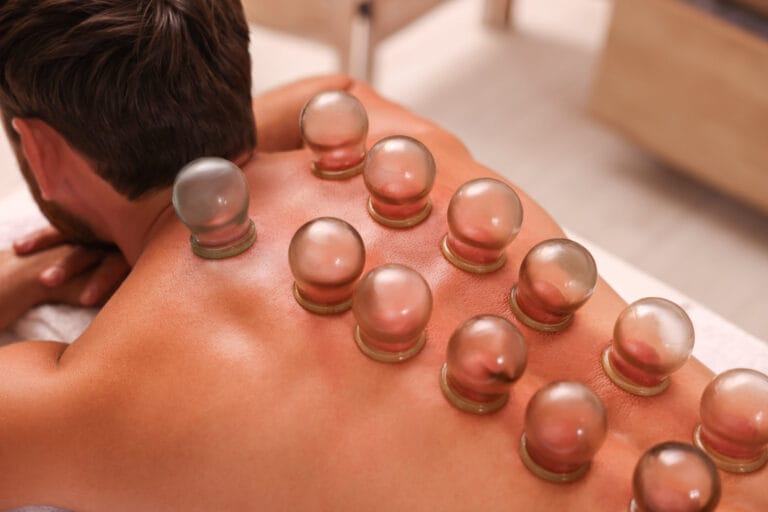 Myofascial Cupping 101: What Is It and How Does It Work?