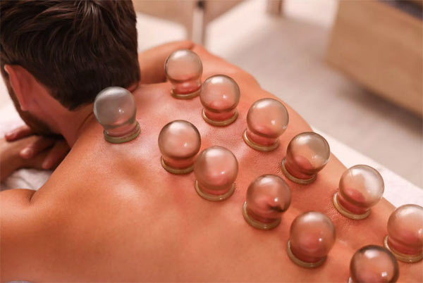 Myofascial-Cupping-1-jpg myofascial cupping edmonton