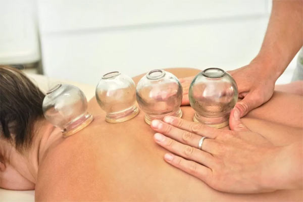 Myofascial-Cupping-Beaumont Myofascial Cupping Beaumont