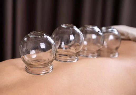 Myofascial-Cupping-Edmonton Myofascial Cupping in Beaumont Edmonton